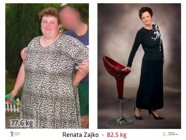 Renata Zajko - jedna z uczestniczek akcji Chudniesz - Wygrywasz Zdrowie