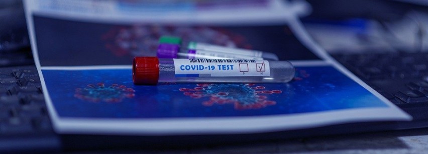 Ostatniej doby testy potwierdziły mniej zakażeń COVID-19 w...