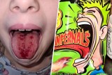Lizak zranił 10-latkę z Torunia. Teraz jej mama ostrzega innych! "To czerwone na języku to krew" 