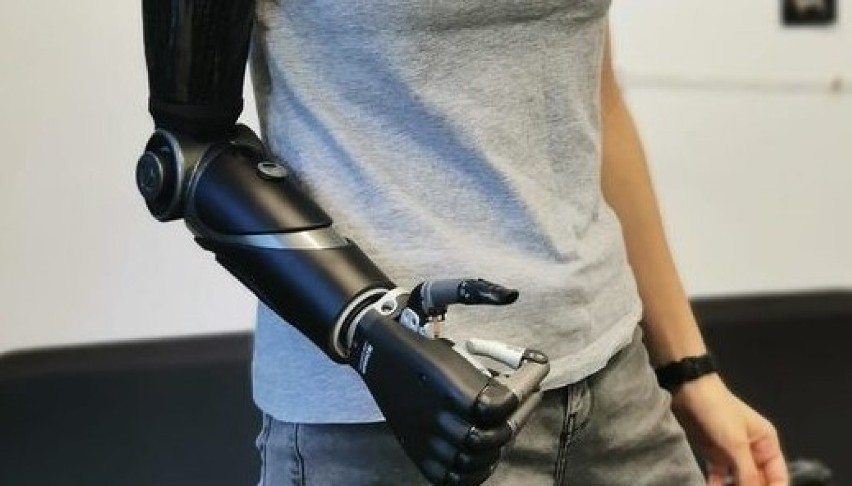 Weronika z protezą bioniczną ILimb Quantum. Prawą rekę...