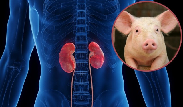 Modyfikacja genetyczna świni polegała na wprowadzeniu do organizmu zwierzęcia ludzkich genów decydujących o tzw. zgodności tkankowej.