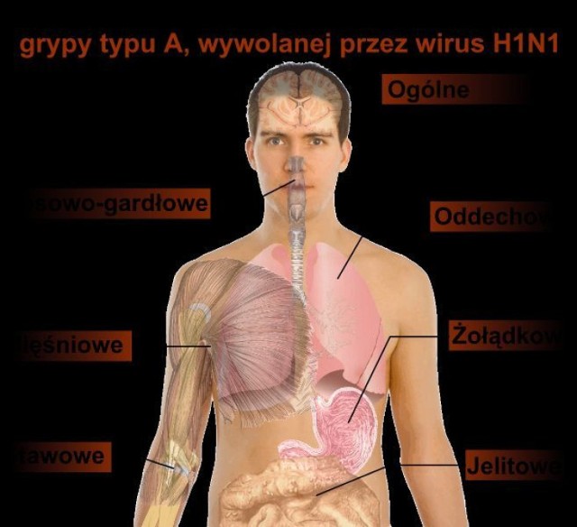 Główne symptomy &quot;świńskiej&quot; grypy u ludzi http://commons.wikimedia.org/wiki/File:Symptoms_of_swine_flu_PL.svg
