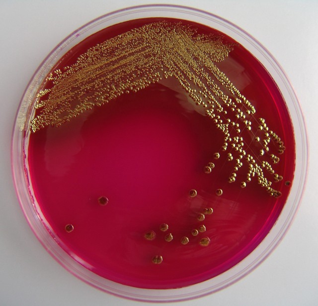 E.coli on Endo agar
