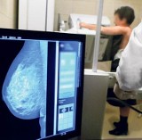 Bielsko-Biała: Bezpłatne badania mammograficzne przy Galerii Sfera