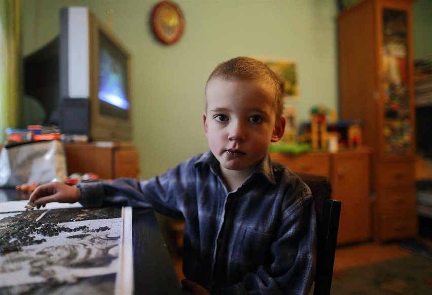 5-letni Szymek przeszedł już dwie operacje z powodu ciężkiej...