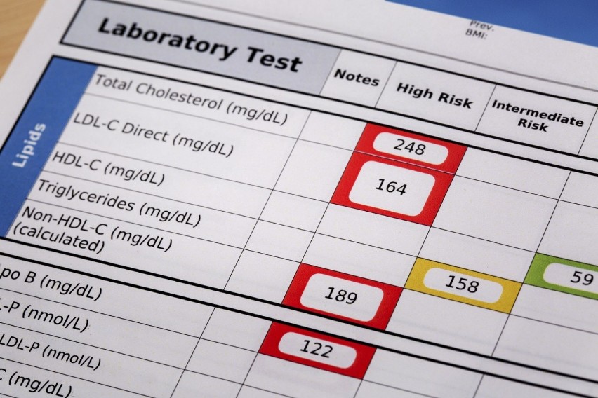 Profil lipidowy, próby wątrobowe czy trójka tarczycowa - te...