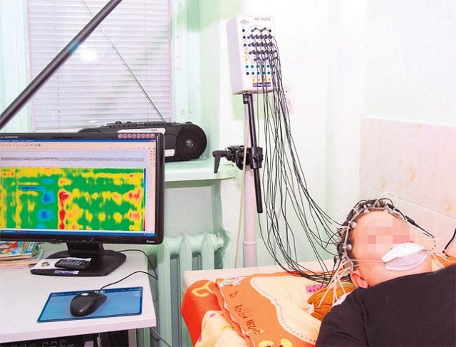 Dzięki urządzeniu do mappingu przestrzenno-czasowego neurolodzy z Ośrodka Pediatrycznego im. Korczaka (szpital im. Kopernika) potrafią wykryć przypadki padaczki u dzieci, nierozpoznawalne innymi metodami.
