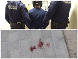Atak nożownika przy ul. Bema w Białymstoku! Ranne dwie kobiety [zdjęcia, wideo]