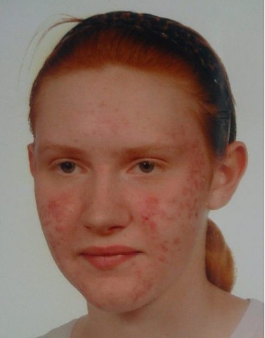 Zaginiona w Zabrzu Sylwia Romańczuk została odnaleziona