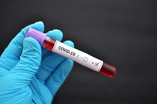 Od początku pandemii odnotowano 71 osób zarażonych koronawirusem.