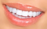 Licówki - czyli sposób na piękne zęby