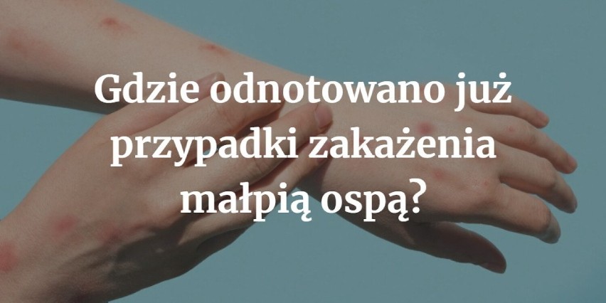 Jak dotąd przypadki zakażenia wirusem małpiej ospy...