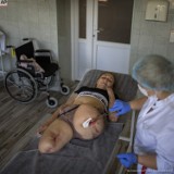 "Zobaczyłam, że nie ma już nóg". Poruszająca fotorelacja z ukraińskich szpitali
