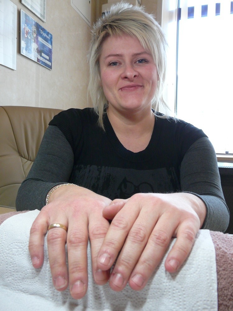 Katarzyna Kogut chciała mieć długie i ładne paznokcie