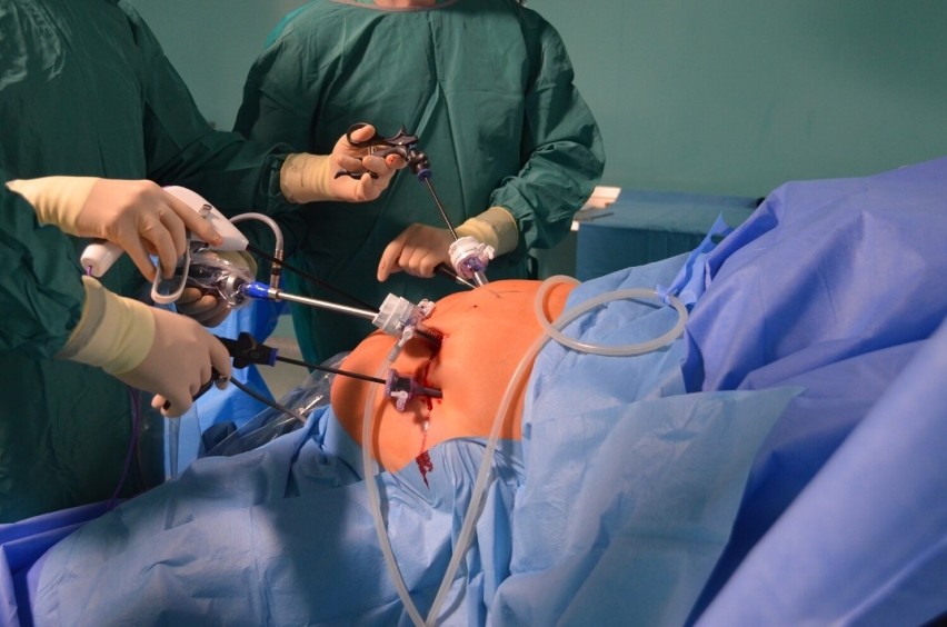 W Mazowieckim Szpitalu Specjalistycznym w Radomiu powstał Ośrodek Bariatryczny. Leczą skrajną otyłość przez operacje żołądka (ZDJĘCIA)