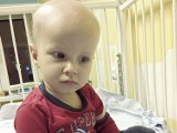 Jastrzębie-Zdrój: 2-letni Szymonek ma raka mózgu. Rodzice zbierają na operację usunięcia guza. Zostało mało czasu...