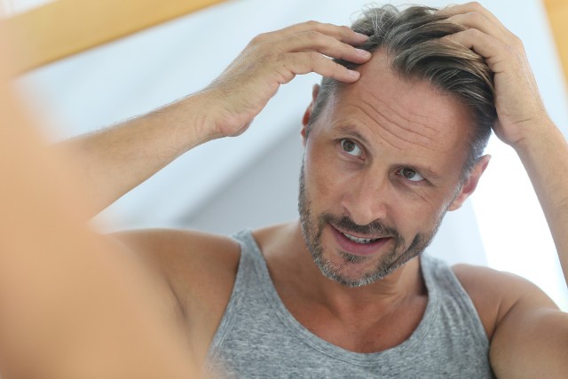 Przerzedzenie się włosów, cofniecie ich linii oraz więcej siwych pasm, to jedna z oznak starzenia się organizmu. Sprawdź na kolejnych slajdach, co jeszcze czeka mężczyzn po 40 roku życia.