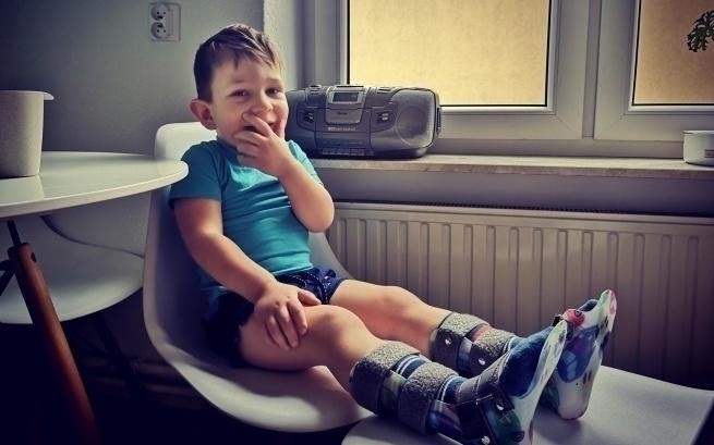 Pomóżmy czteroletniemu Ignasiowi Sobczakowi z Kielc pozbyć się przykurczy mięśniowych. Tak niewiele brakuje! (ZDJĘCIA, WIDEO)