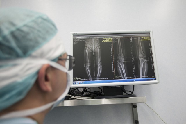 W sosnowieckim Szpitalu Miejskim specjaliści jako pierwsi w województwie śląskim wszczepili pacjentce nowatorski implant BioPoly RS do częściowej protezoplastyki kolana