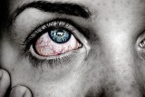Masz takie objawy? Czerwone oczy po przebudzeniu mogą oznaczać poważne problemy!