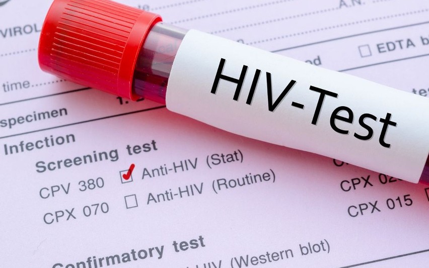 HIV to wirus niedoboru odporności, do zakażenia się nim...
