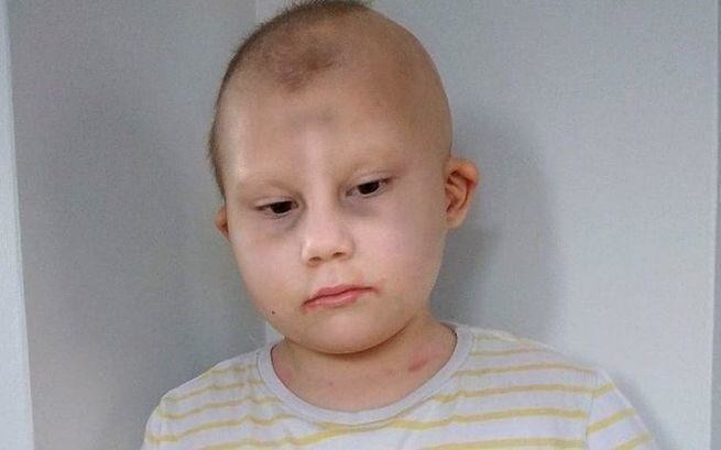 Pięcioletnia Marianka z Sosnowca pojedzie na leczenie do...