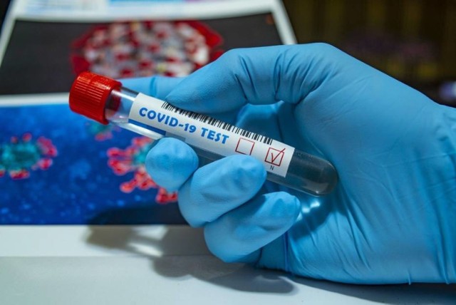 Osocze ozdrowieńców może pomóc chorym na koronawirusa. Mogą zgłaszać się do Regionalnego Centrum Krwiodawstwa i Krwiolecznictwa w Bydgoszczy