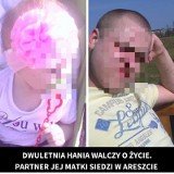 Hania nadal walczy o życie. Partner jej matki jest w areszcie [ZDJĘCIA,  WIDEO]