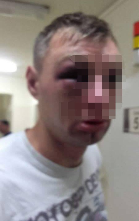 Policjanci w Zduńskiej Woli pobili brutalnie mężczyznę? Zatrzymany był agresywny i miał narkotyki