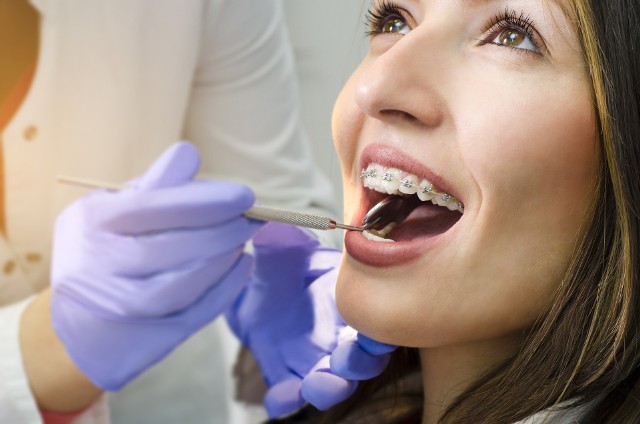 Całkowity koszt leczenia za pomocą aparatu ortodontycznego może wynieść nawet ponad 20 tys. w zależności od wady zgryzu oraz czasu leczenia.