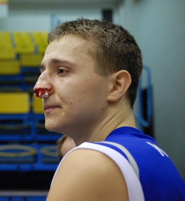 Po meczu w Słupsku Bartosz Diduszko miał złamany nos i przymusową przerwę w grze.