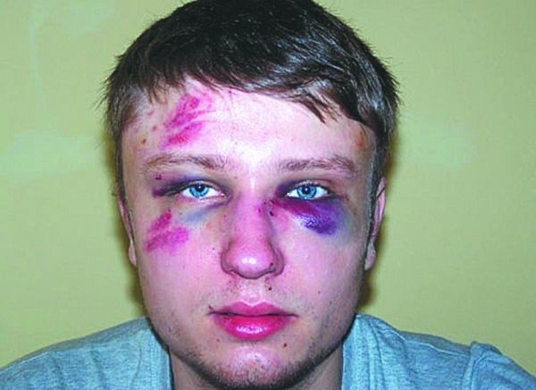 Pobity na Basowiszczach Białorusin był pijany, dlatego policjanci nie przyjęli zawiadomienia o pobiciu. Byli jednak na miejscu i szukali sprawców.