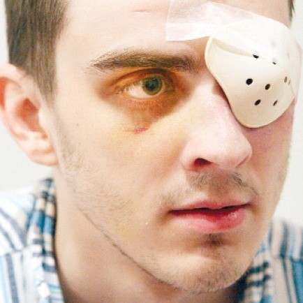 Kamil Sawicki w wypadku stracił oko.