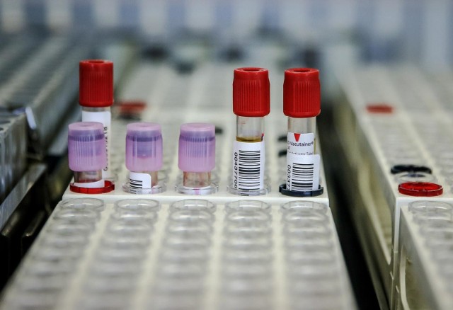 PZPN zapłaci nawet milion złotych za testy na koronawirusa