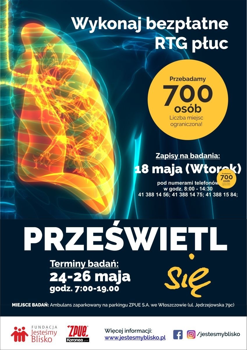 Sprawdź płuca! Włoszczowska Fundacja Jesteśmy Blisko zaprasza na bezpłatne badania. Szczególnie osoby po przebytej chorobie Covid-19