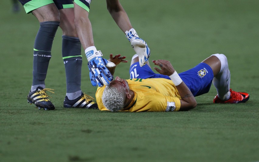Brazylia - Boliwia 5:0. Neymar trafiony w łuk brwiowy