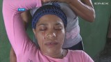 Kobieta z Dominikany płacze "krwawymi łzami" [wideo]