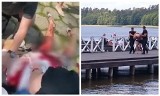 Augustów. Nożownik zabił kobietę na oczach plażowiczów i poszedł popływać. Usłyszał zarzuty (zdjęcia, wideo)