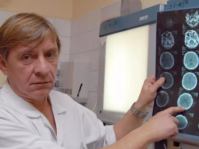 Dr n. med. Jan Flakiewicz, ordynator w Szpitalu Wojewódzkim nr 2: - Tkanka mózgowa jest niezwykle delikatna. Podczas zabiegu wymgagana jest wyjątkowa precyzja