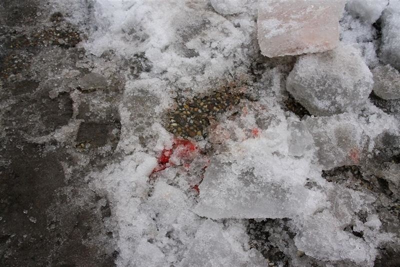 Bryla lodu zranila kobiete na Ozimskiej