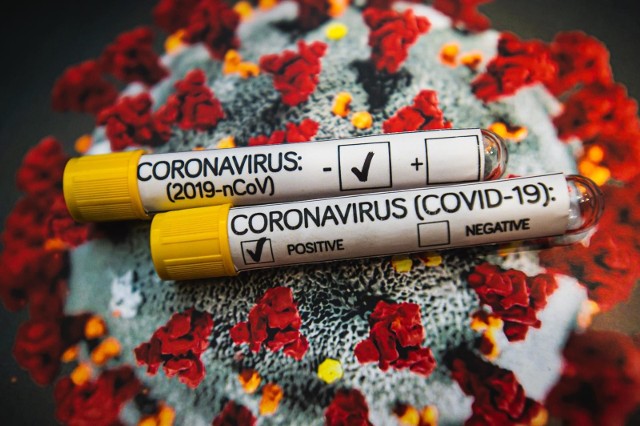 Koronawirus na Pomorzu 21.03.2020 - potwierdzono kolejne 3 przypadki.