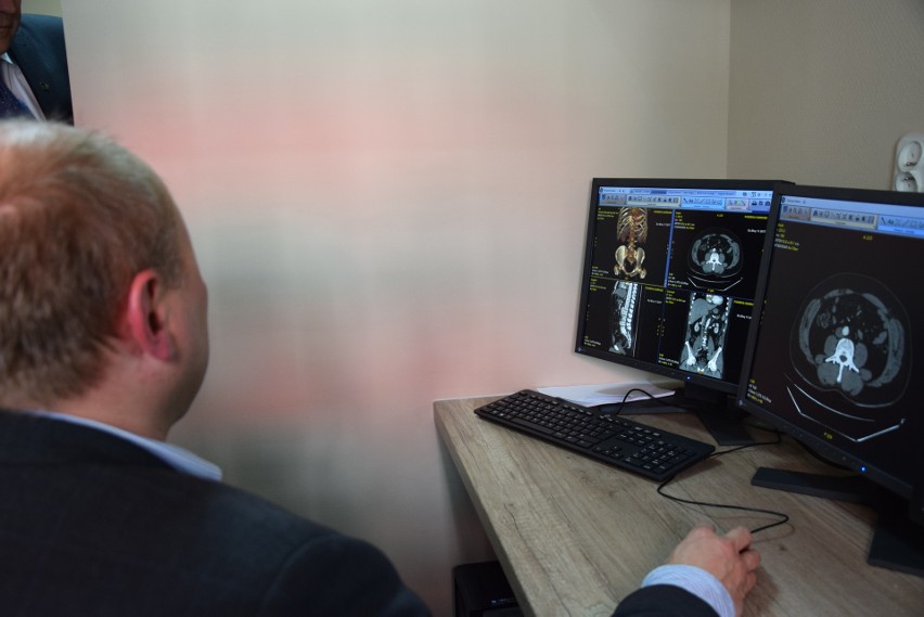Świetochłowice: Nowy tomograf i rentgen w Zespole Opieki Zdrowotnej ZDJĘCIA