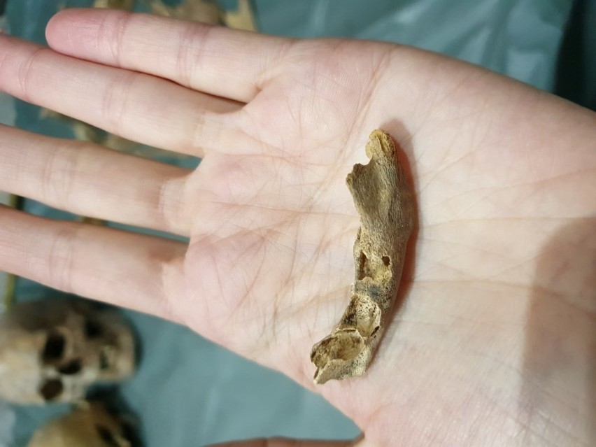 Fragment żuchwy dziecka zmarłego w wieku okołoporodowym