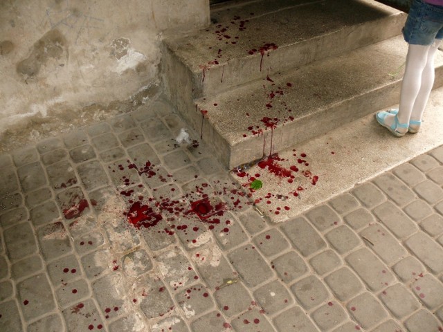 Krew przy wejściu do klatki schodowej.