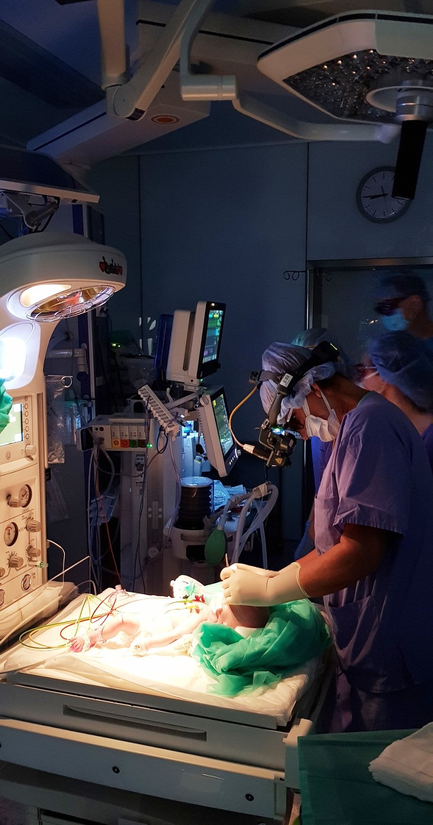 W UCK w Gdańsku po raz pierwszy wykonano laseroterapię u noworodka z retinopatią - chorobą siatkówki