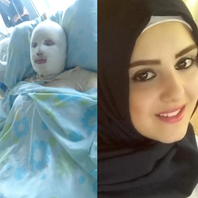 21-letnia Libanka Hana Mohammed Khodor była w piątym miesiącu ciąży i trafiła do szpitala w Trypolisie w stanie krytycznym