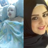 Liban: Mąż oblał ciężarną żonę benzyną  i podpalił. Kobieta walczy o życie. Dlaczego to zrobił?