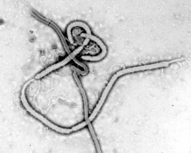 Wirus Ebola (EBOV)