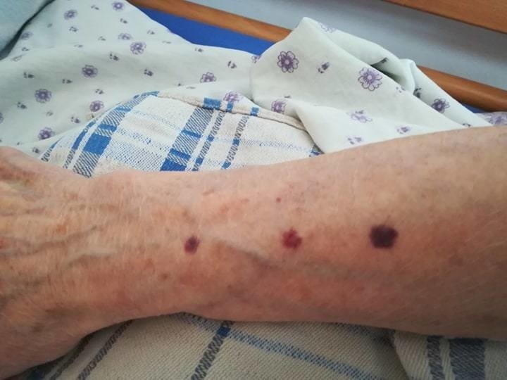 Białystok. Opiekunka pobiła 79-letnią podopieczną. Usłyszała wyrok 8 miesięcy więzienia (zdjęcia)