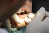 Pacjentka: dentystka naraziła zdrowie moje i nienarodzonego dziecka